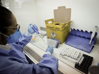 DF: 29 casos importados de malária em 2025